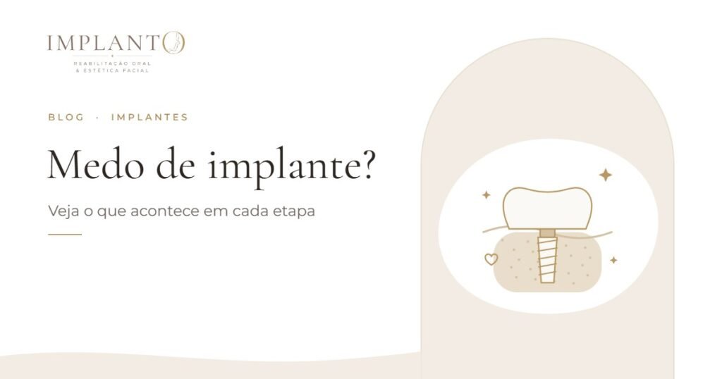 Medo de implante? Veja o que acontece em cada etapa