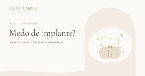 Medo de implante? Veja o que acontece em cada etapa
